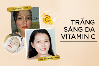 vitamin-c-lam-trang-da-mat