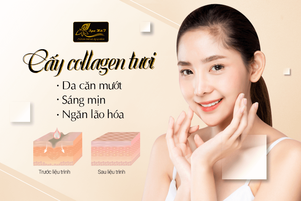 cay-collagen-tuoi