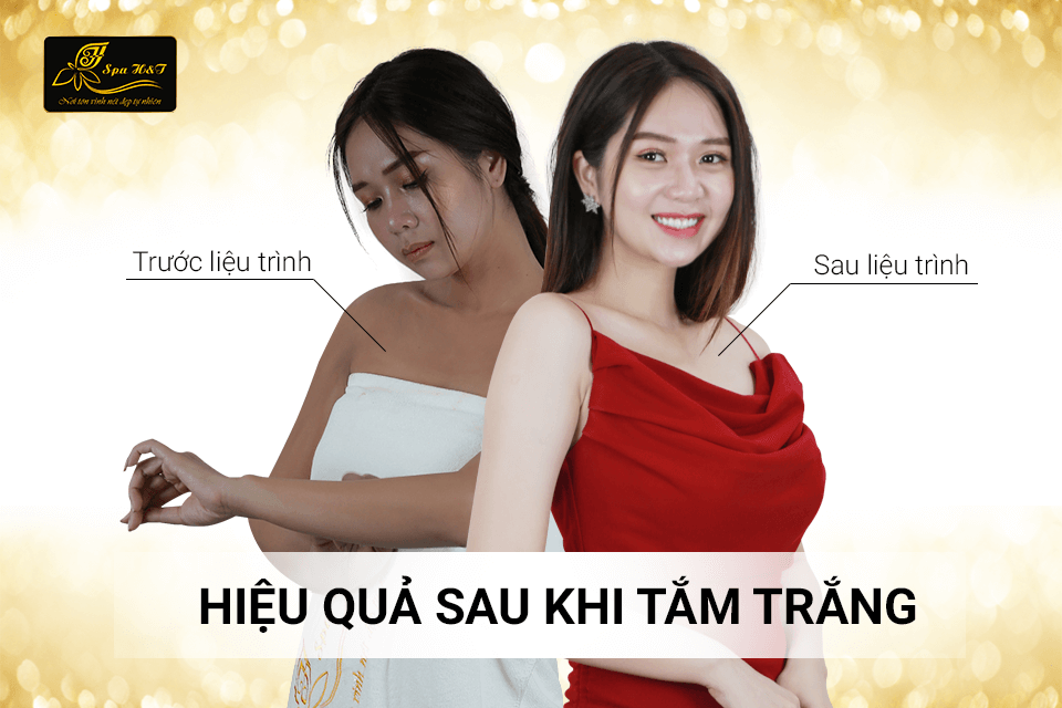 hieu-qua-tam-trang-tai-ht-spa