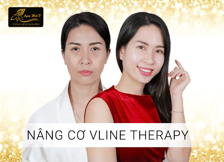 nang-co